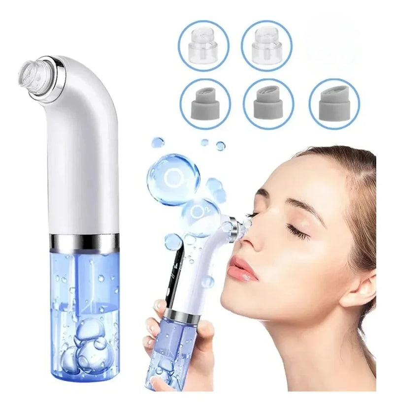 Aspirator pentru puncte negre